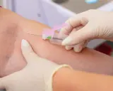 Pobieranie krwi do badań. Wyniki wskazują na limfocyty podwyższone, co może świadczyć o infekcji.