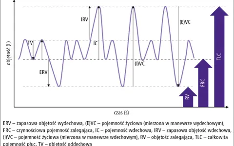 Wykres przedstawia prawidłowy wynik spirometrii z zaznaczonymi objętościami płuc, takimi jak TV, ERV, IRV, IC, (I)VC, (E)VC, RV, FRC i TLC.