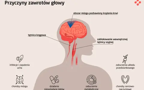 Ilustracja pokazuje mózg z zaznaczonym obszarem bez dopływu krwi, co może powodować dziwne uczucie w głowie. Wymieniono też inne przyczyny zawrotów głowy.