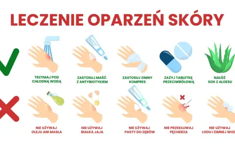 Co na oparzenie? Chłodna woda, maść z antybiotykiem, zimny kompres, tabletka przeciwbólowa, sok z aloesu. Nie używaj masła, jajka, pasty do zębów, lodu. Nie przekłuwaj pęcherza.