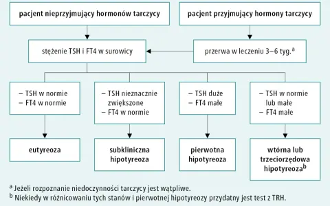 Schemat diagnostyki niedoczynności tarczycy, uwzględniający nowy lek. Analiza TSH i FT4 pomaga rozpoznać stan pacjenta.