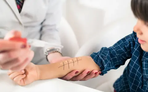 Lekarz wykonuje test skórny u dziecka, by sprawdzić, czy alergia jest dziedziczna. Na ramieniu chłopca widać krople płynu i zaznaczone pola.