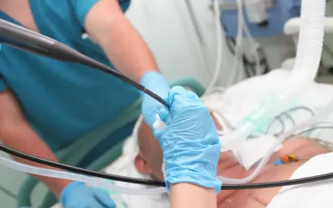 Lekarz w niebieskich rękawiczkach wykonuje bronchoskopię, wprowadzając endoskop do dróg oddechowych pacjenta podłączonego do respiratora.