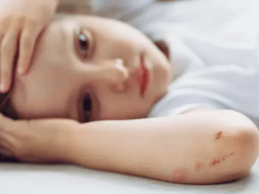Dziecko z zaczerwienionymi otarciami na łokciu, które mogą świadczyć o swędzeniu skóry u dziecka bez wysypki.