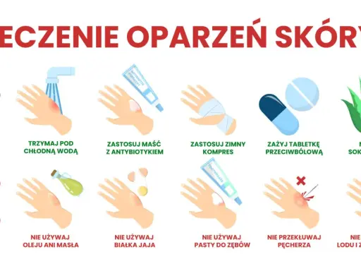 Co na oparzenie? Chłodna woda, maść z antybiotykiem, zimny kompres, tabletka przeciwbólowa, sok z aloesu. Nie używaj masła, jajka, pasty do zębów, lodu. Nie przekłuwaj pęcherza.