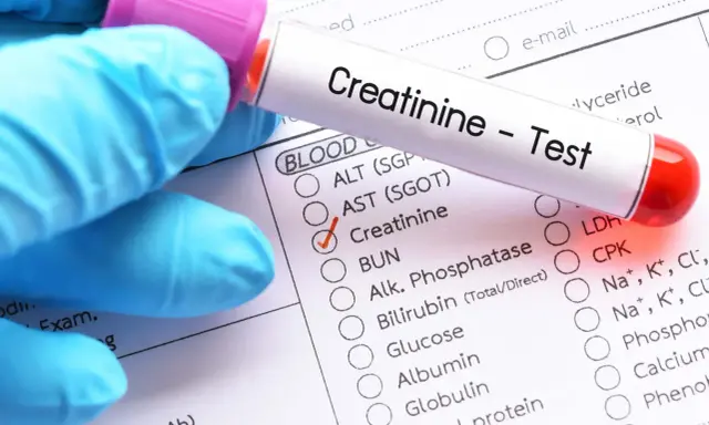 Rękawiczka w niebieskiej rękawiczce trzyma probówkę z napisem "Creatinine - Test". Obok zaznaczono pole "Creatinine" na formularzu badań krwi.