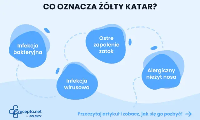 Żółty katar może oznaczać infekcję bakteryjną, wirusową, zapalenie zatok lub alergiczny nieżyt nosa. Dowiedz się więcej.