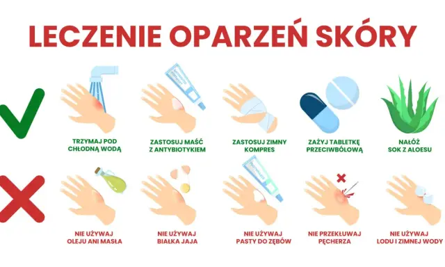 Co na oparzenie? Chłodna woda, maść z antybiotykiem, zimny kompres, tabletka przeciwbólowa, sok z aloesu. Nie używaj masła, jajka, pasty do zębów, lodu. Nie przekłuwaj pęcherza.