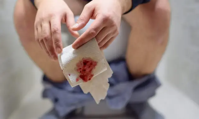 Dłoń trzymająca papier toaletowy z widoczną krwią. To może być objaw problemów zdrowotnych, takich jak krew w stolcu.