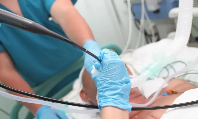 Lekarz w niebieskich rękawiczkach wykonuje bronchoskopię, wprowadzając endoskop do dróg oddechowych pacjenta podłączonego do respiratora.