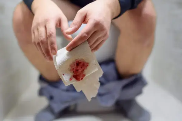 Dłoń trzymająca papier toaletowy z widoczną krwią. To może być objaw problemów zdrowotnych, takich jak krew w stolcu.
